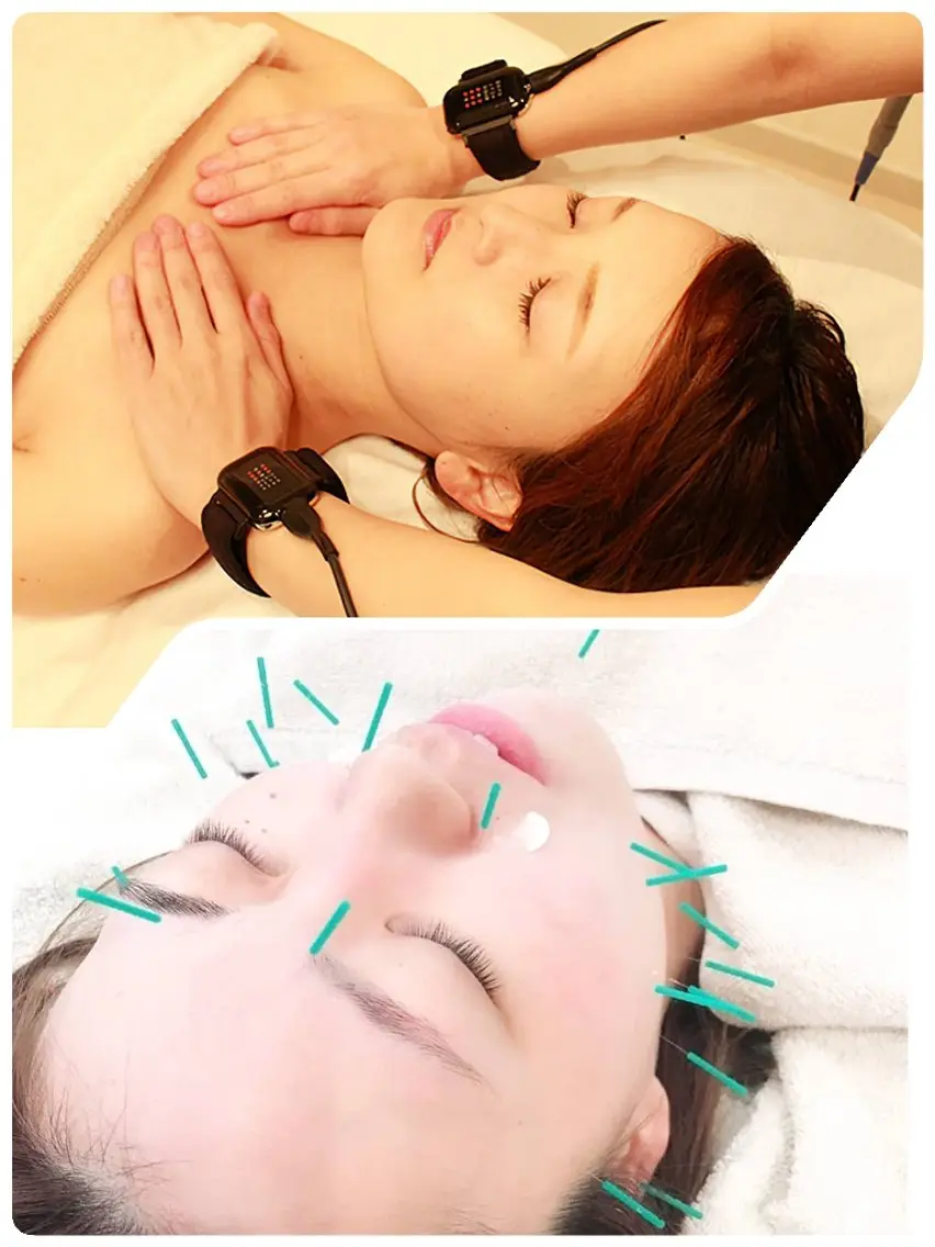 ✨大事なイベントに向けて✨ラグジュアリー➕美容鍼の写真