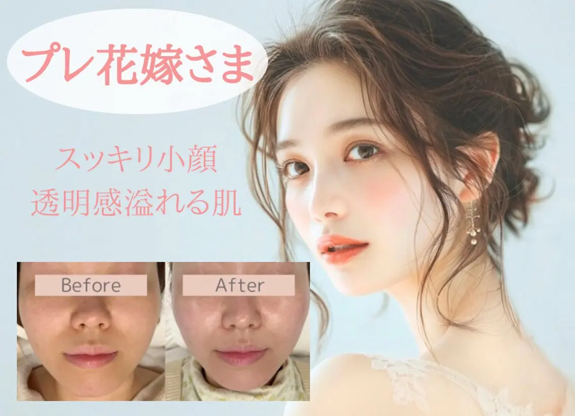 エステ 小顔/毛穴/ニキビ salon bealのエステ・リラクイメージ