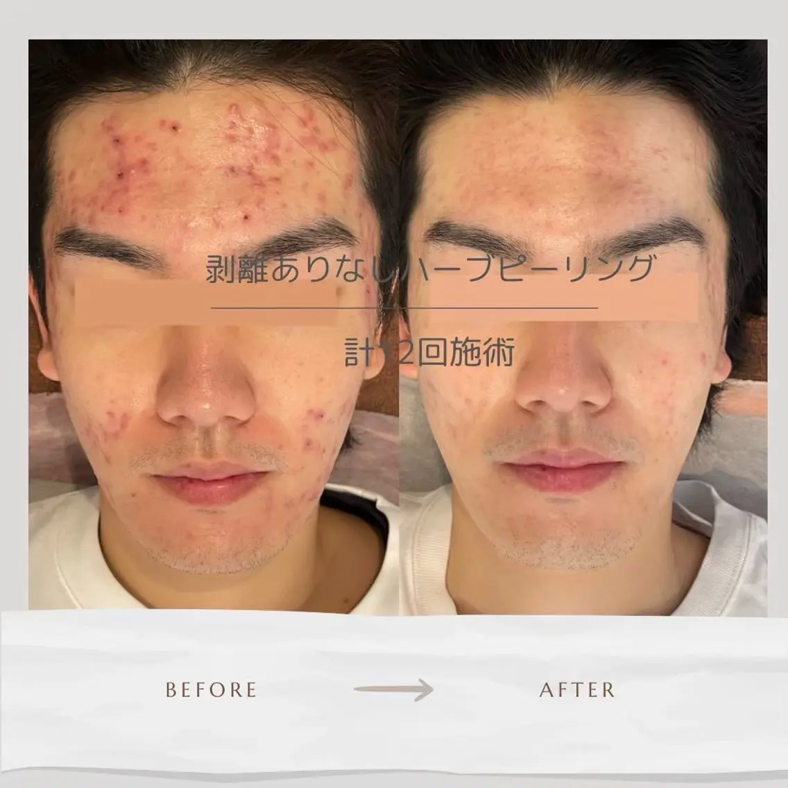 Life Salon別府店のエステ・リラクイメージ
