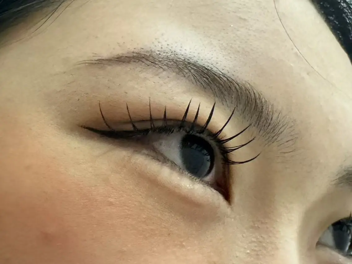 フラットラッシュ140本の写真