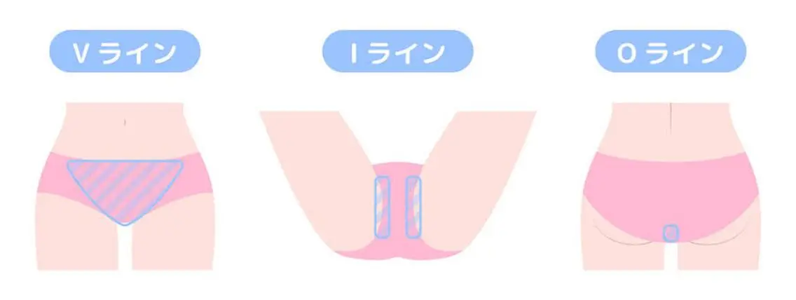脱毛 廣木 麻衣子のエステ・リラクイメージ
