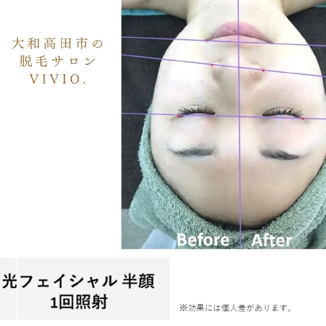 女性専用脱毛 サロンvivio.のエステ・リラクイメージ