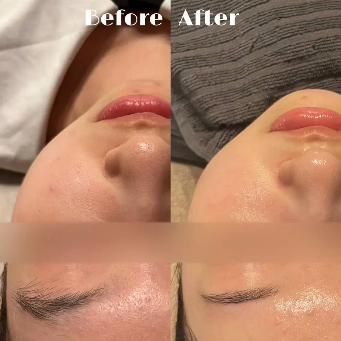 【先着5名🧖🏻♀️】ふわもち肌に♡毛穴すっきり洗浄体験🫧の写真