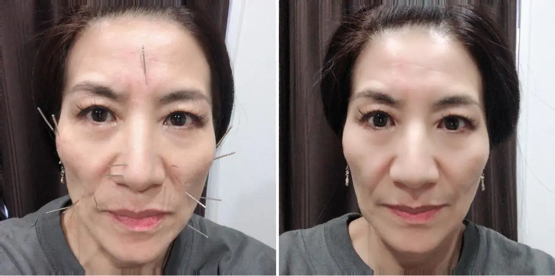 セントラル鍼灸院 Re:laxyのヘアスタイル