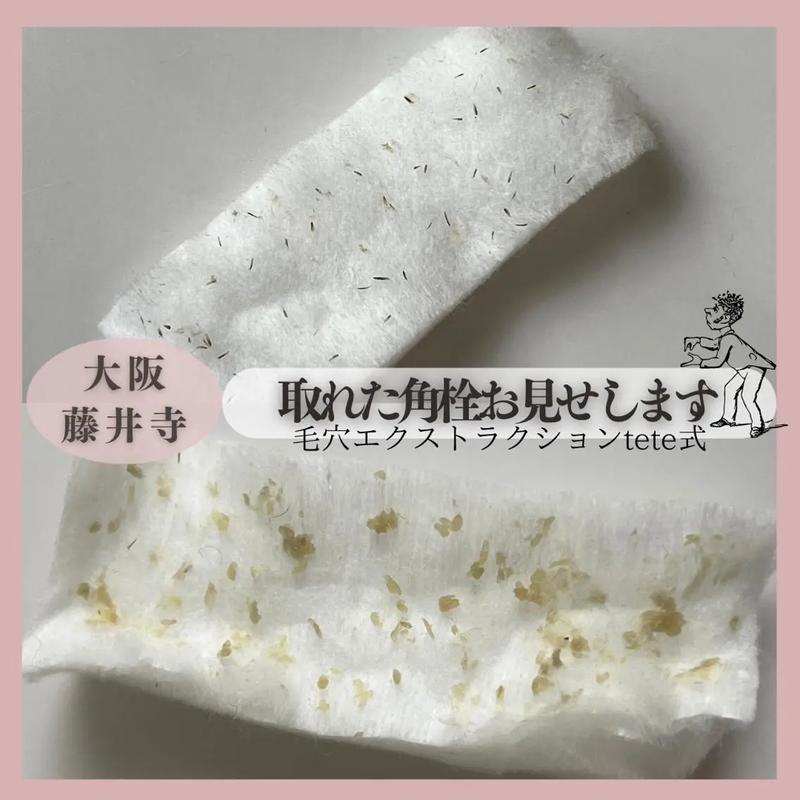エステ Muqu. 毛穴サロンのエステ・リラクイメージ