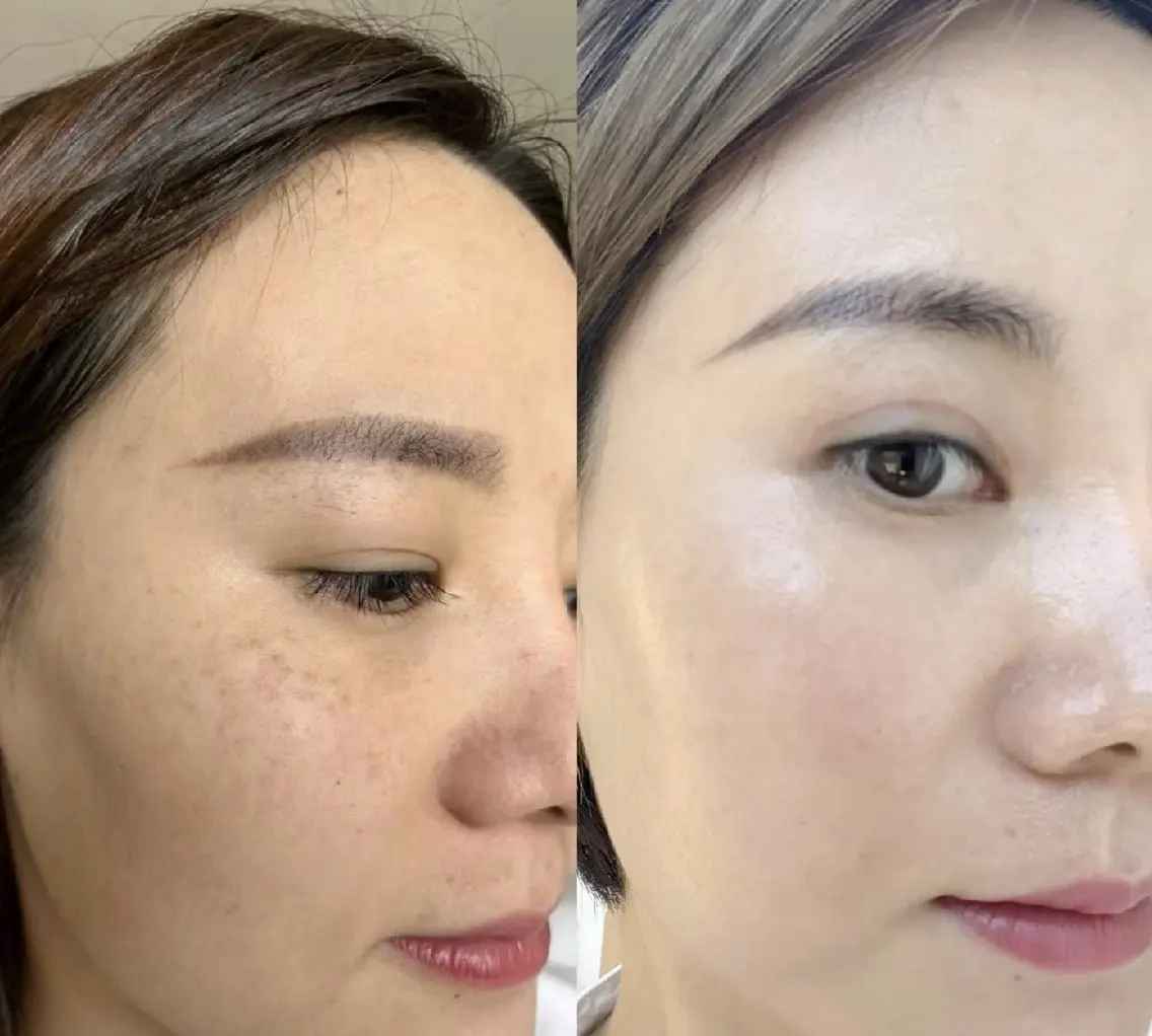 マツエク・マツパ エステ 愛維美水光専門店 川崎彩鳳のエステ・リラクイメージ
