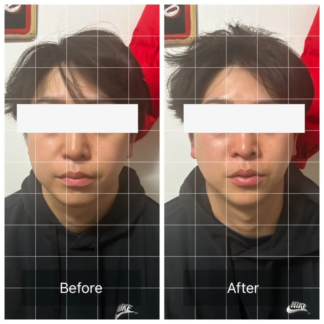 【スッキリ小顔！】メンズ小顔矯正＋ドライヘッドスパの写真