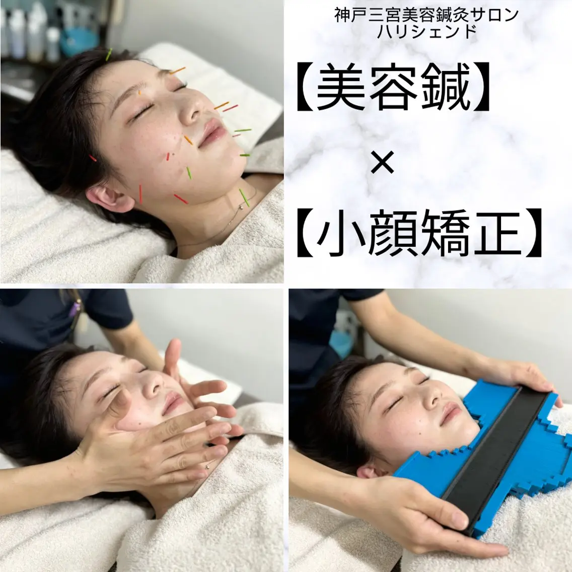 美容鍼・小顔矯正 ハリシェンドのエステ・リラクイメージ