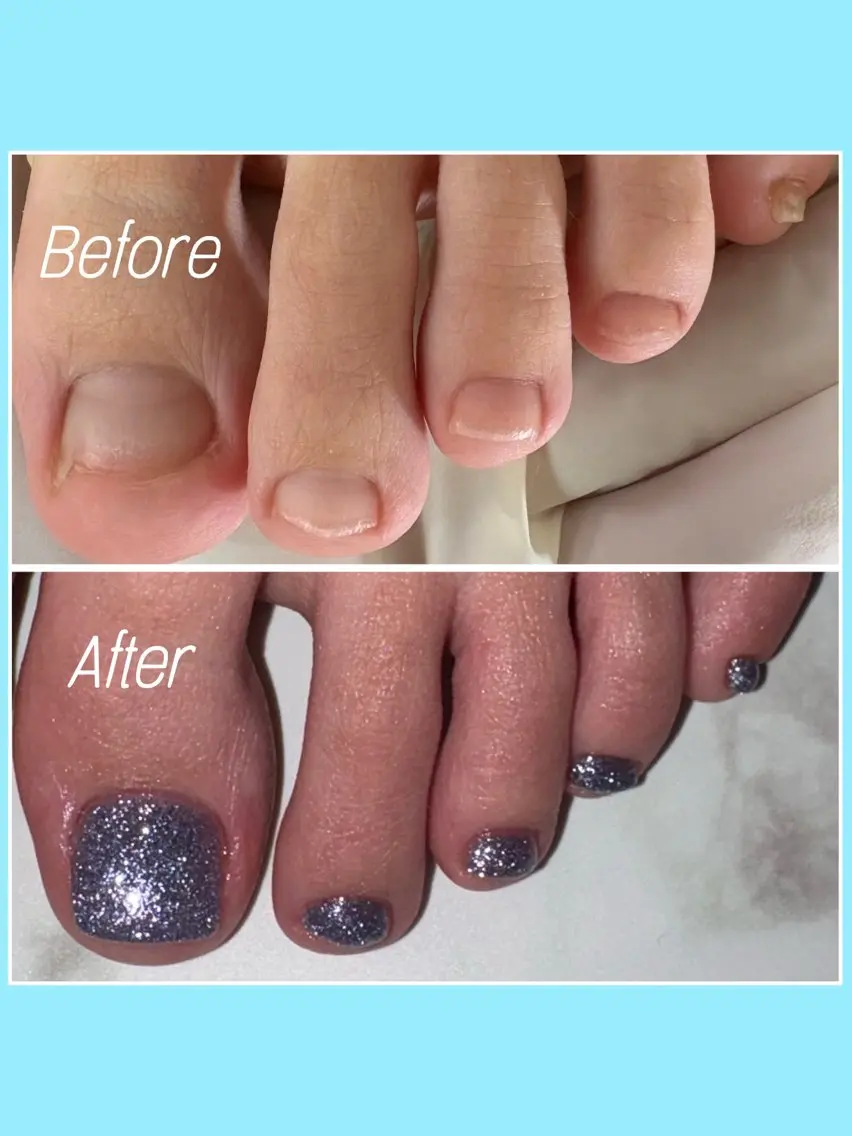 ネイル 長さ出し フラッシュネイル ジェルネイル フットネイル nail salon petillantのネイルデザイン
