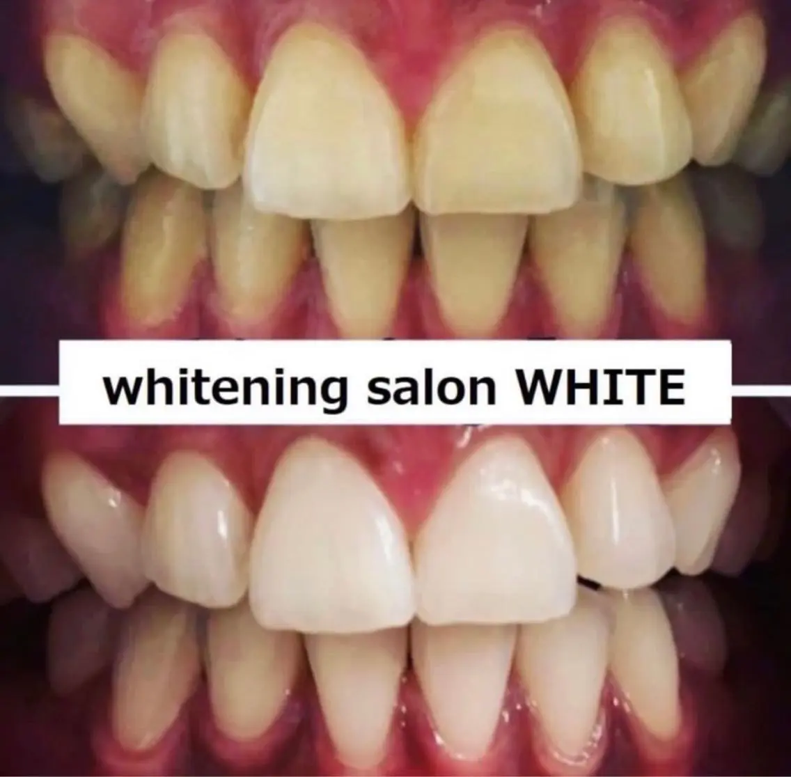 セルフホワイトニング 専門店WHITE広島のその他イメージ