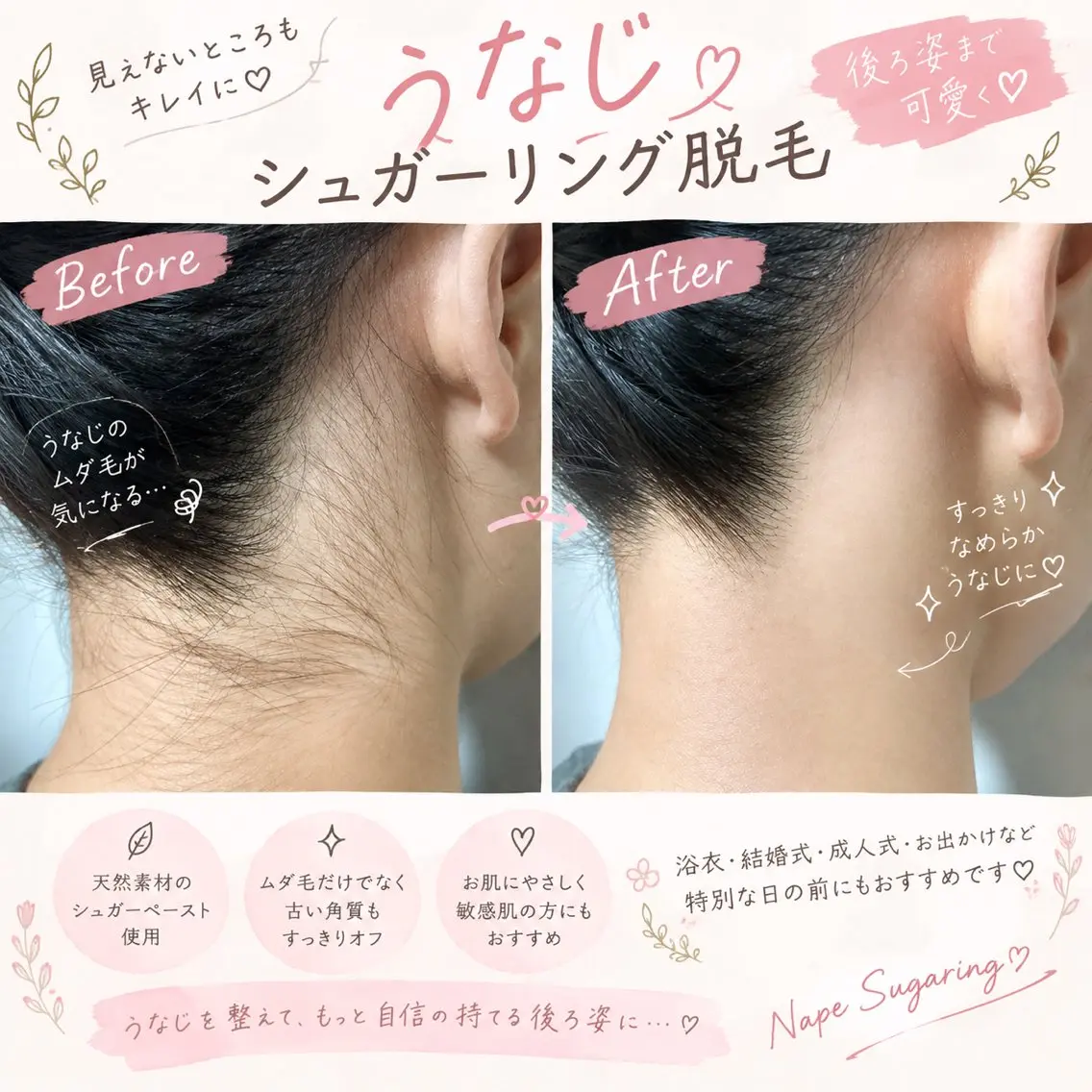 脱毛 パッチリオメメ 小田島のエステ・リラクイメージ