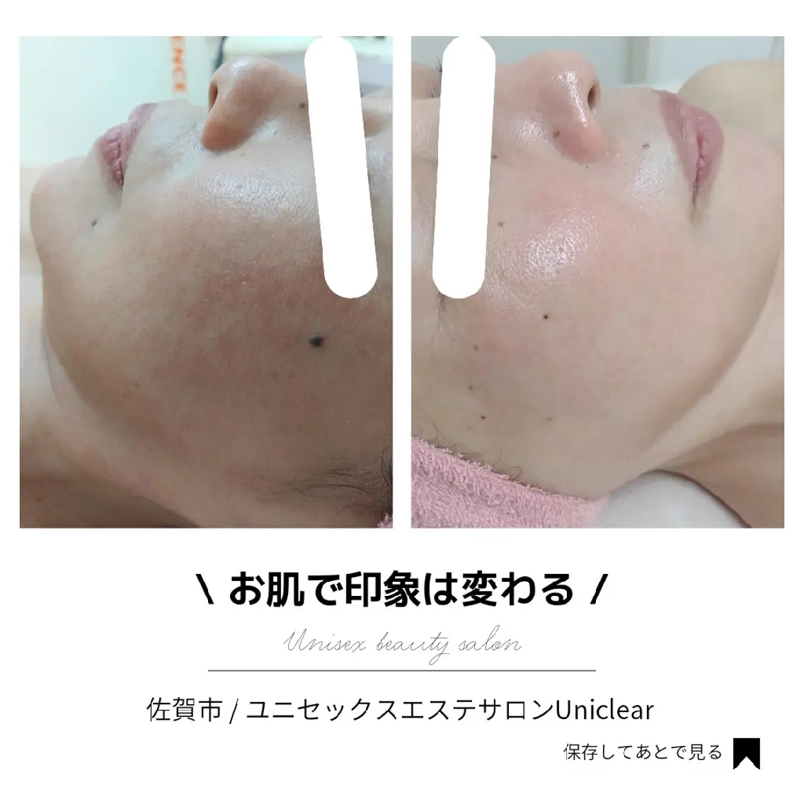 佐賀│男女エステ ユニクリアのエステ・リラクイメージ