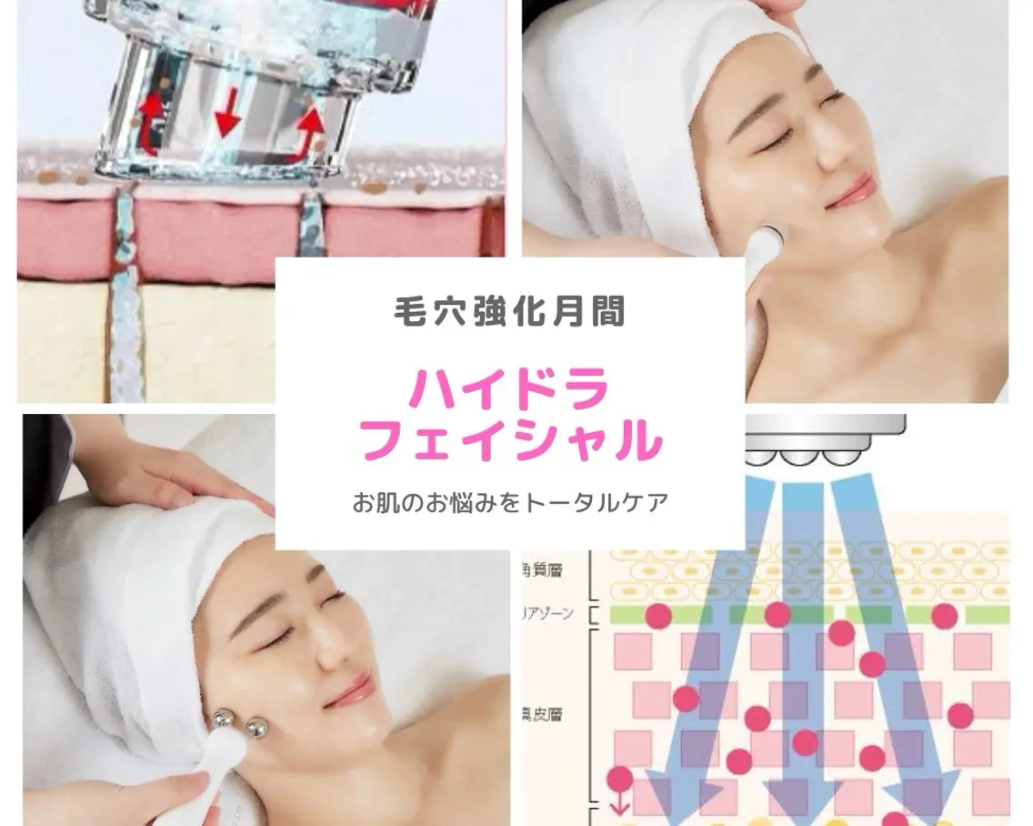 【大人気】毛穴汚れを徹底洗浄ハイドラコース¥7,900/今なら無料肌診断付♪潤いのあるツヤ肌に◎の写真