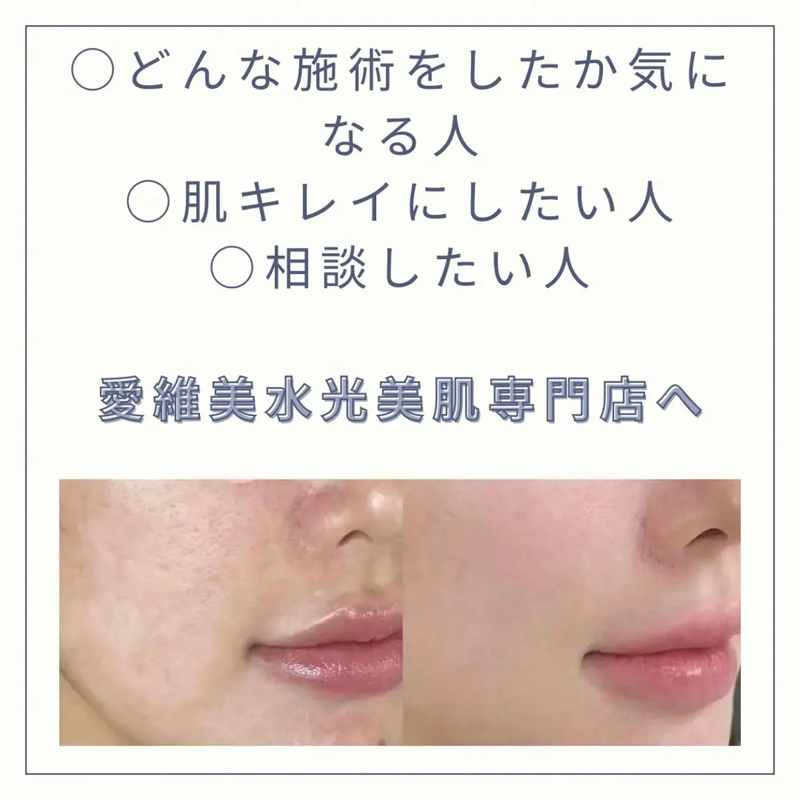 エステ リラク 愛維美水光美肌専門店 メンズレディースokのエステ・リラクイメージ