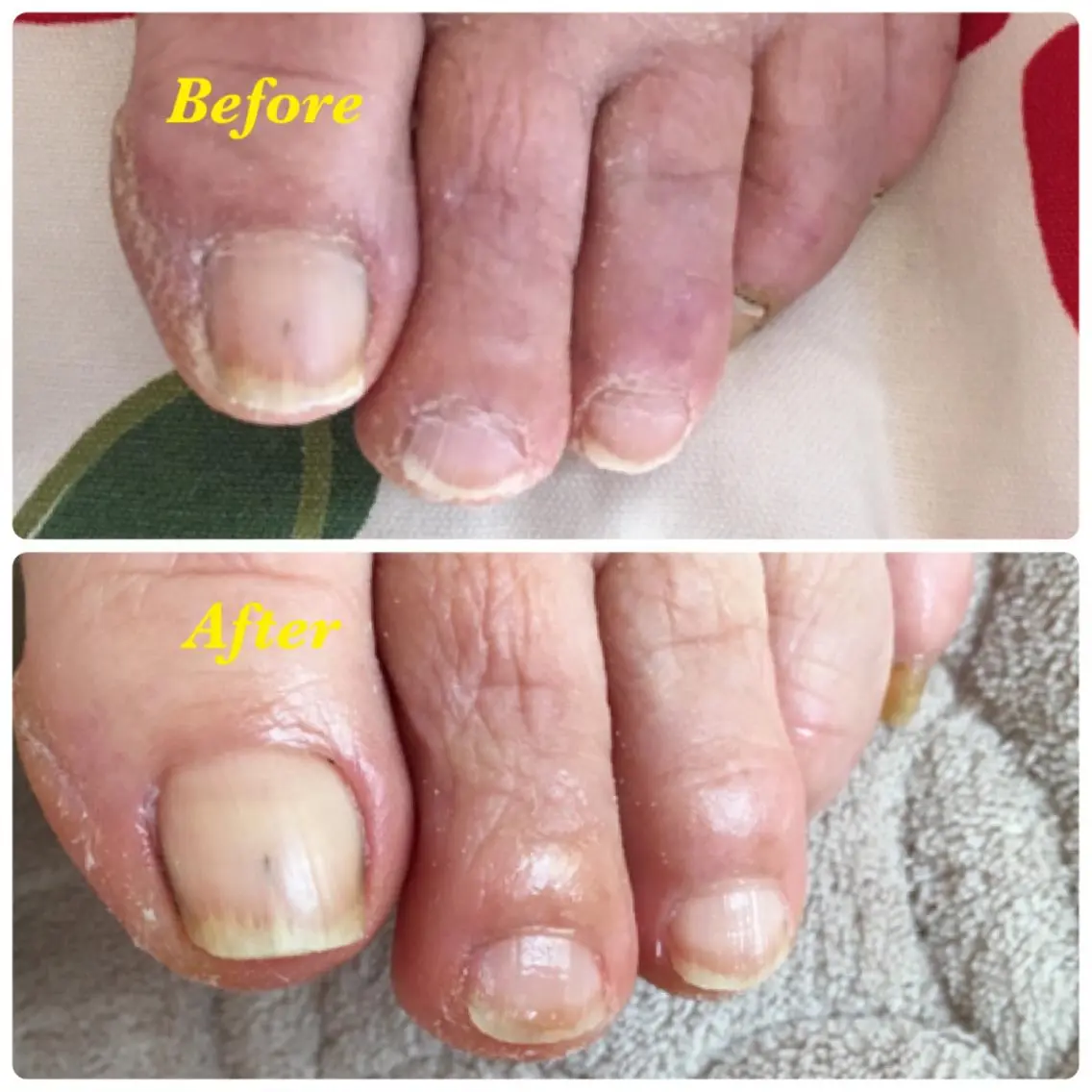 ネイル フットネイル SantéNail SAYAKAのネイルデザイン