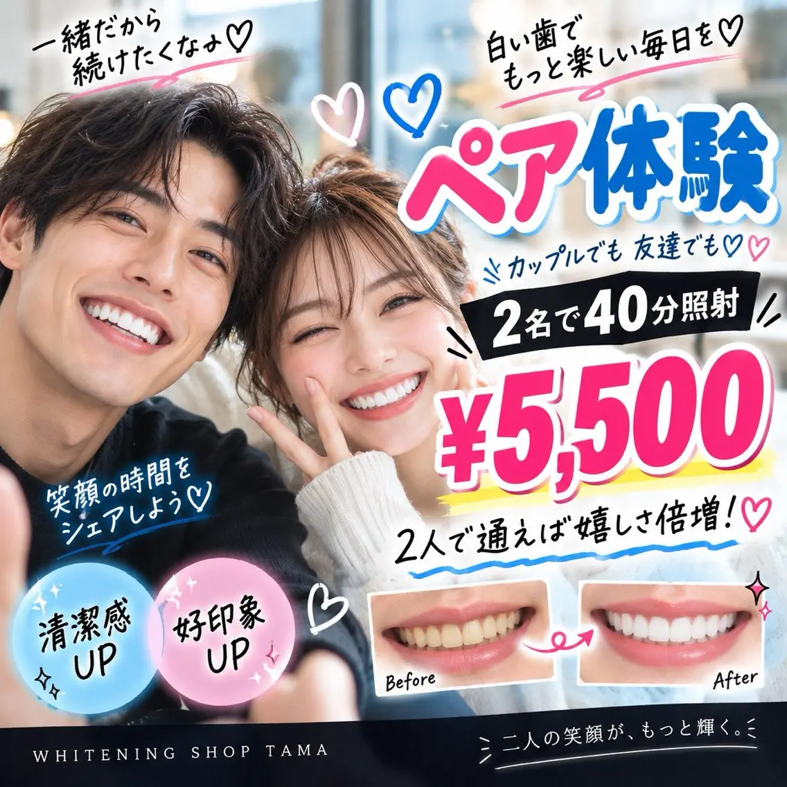 👫2人でお得にホワイトニング💕ペア40分照射¥5,500🦷✨カップル・友達OK!の写真