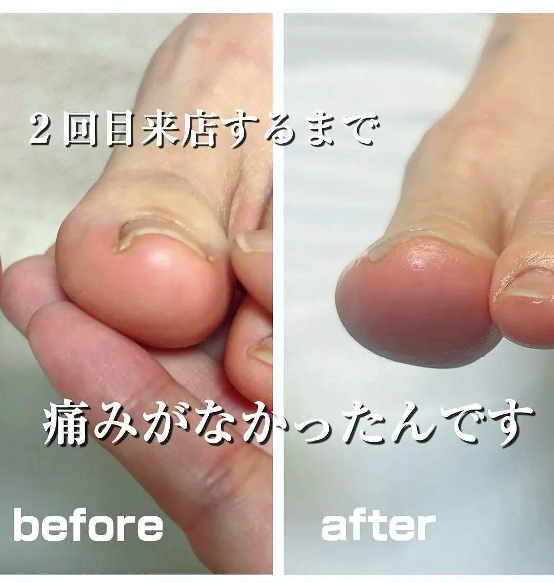 その他 フットケアサロン Kotoriのその他イメージ