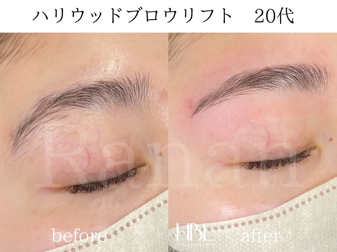 アイブロウ ワックス脱毛 その他(アイブロウ) 韓国肌管理/眉毛専門 Ranan(ラナン)の眉毛・アイブロウイメージ