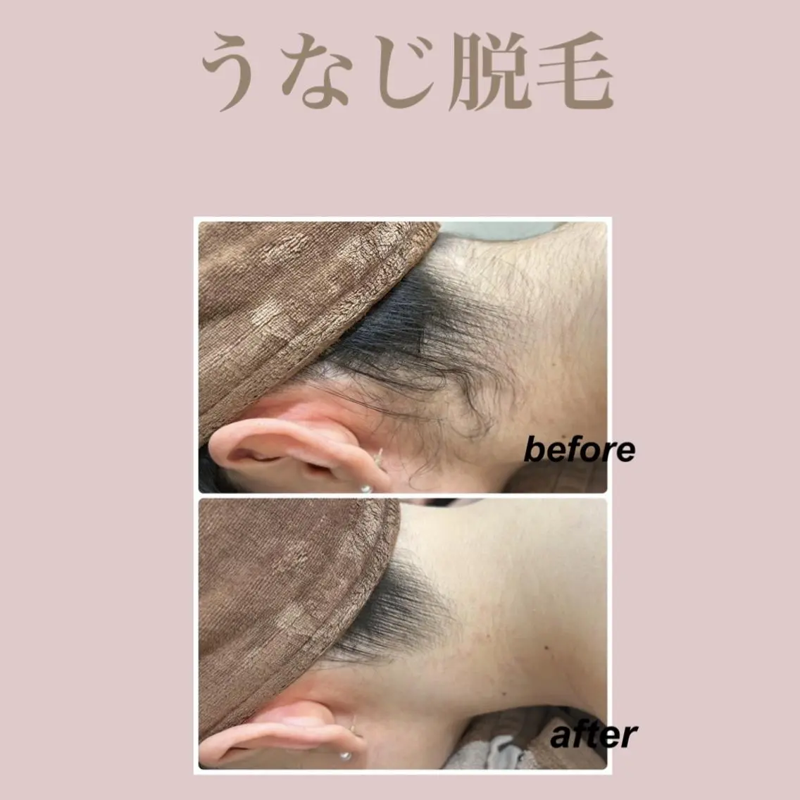 🌈Linora🌈 レイビス 永石のエステ・リラクイメージ