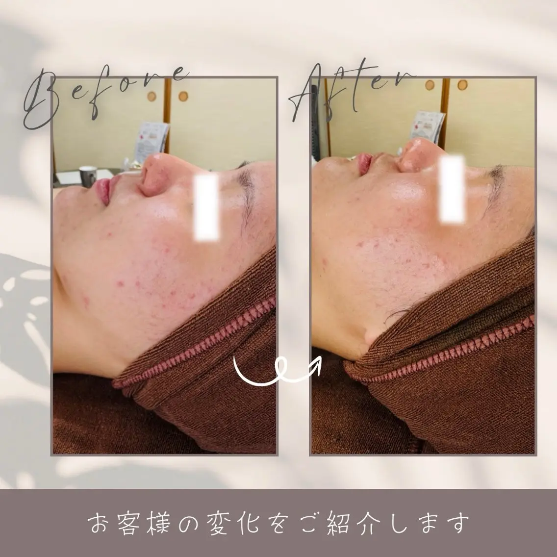 LukeBeauty salonのエステ・リラクイメージ