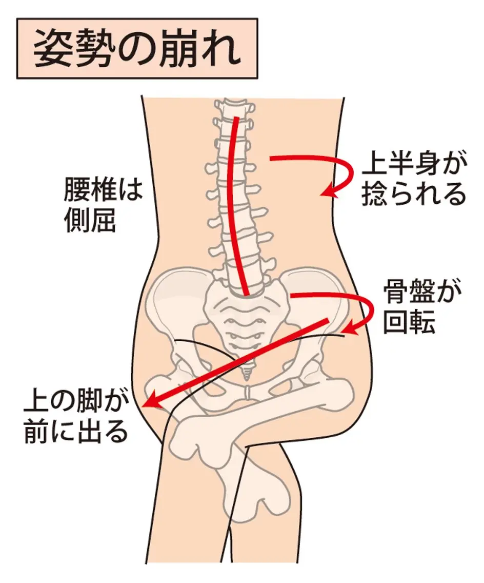 【産前産後の骨盤リセット】ゆがみケアでママの体を整える✨出産による骨盤のゆるみをやさしく整え、体の軸を取り戻しましょう！の写真