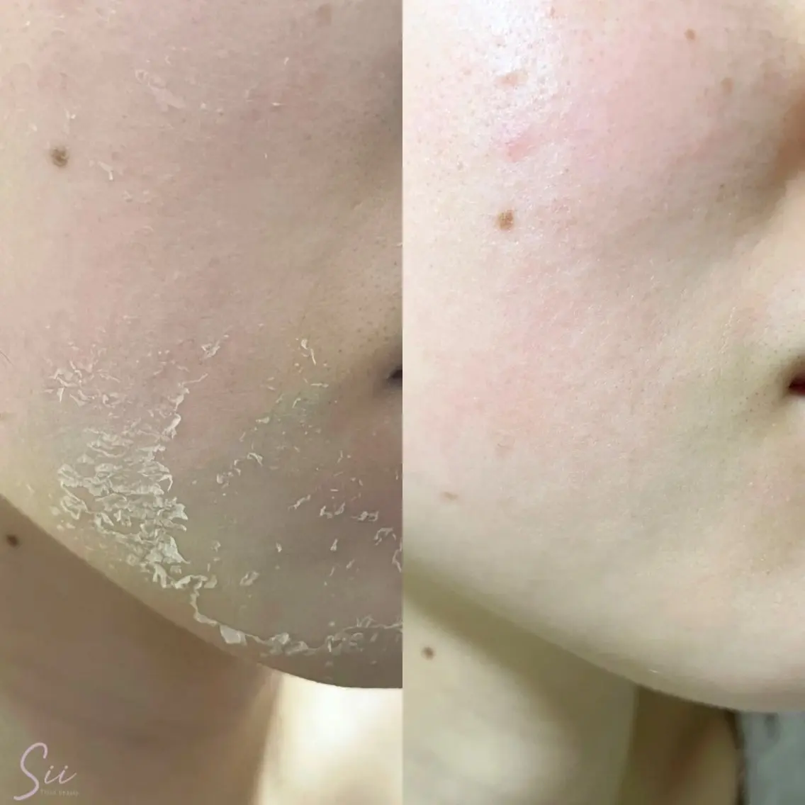エステ T-SALON (BODYCARE)の眉毛・アイブロウイメージ