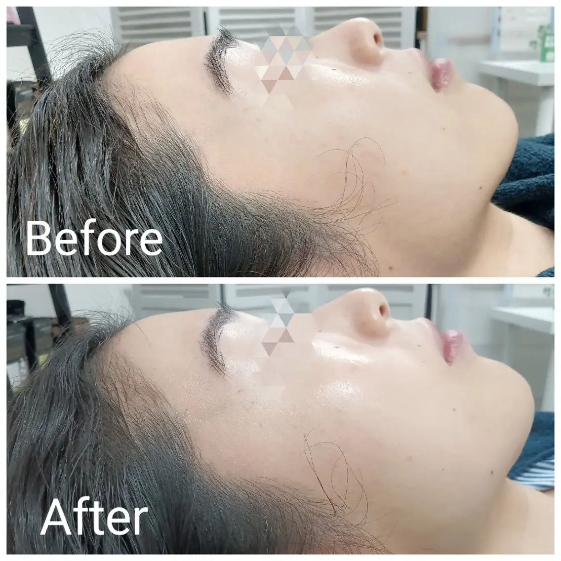 エステ リラク 肌質改善Beauty salon Renのエステ・リラクイメージ