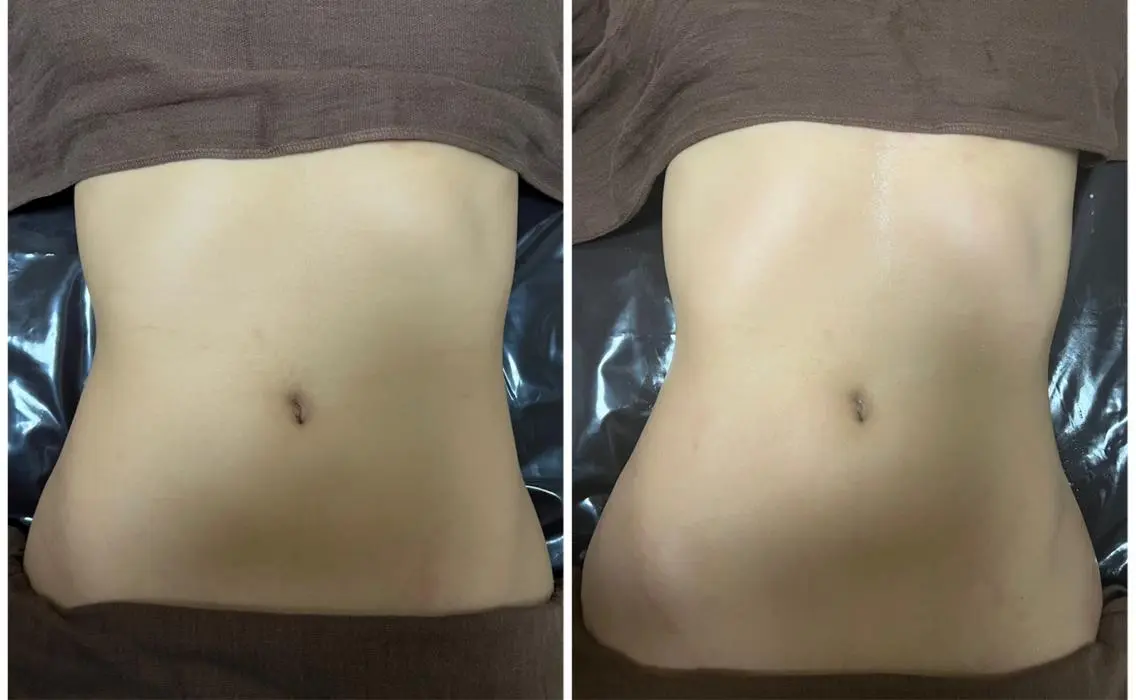 【アロマ×美容整体×EMS】1箇所集60分コース✨リンパ・骨格・筋肉アプローチでトータルケア🫶たるみや引き締めも❣️の写真