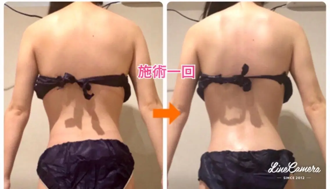 ショート カラー パーマ ヘアアレンジ メンズ キッズ ネイル マツエク・マツパ ‍痩身＆ボディ 結果出し🌟丹野のエステ・リラクイメージ