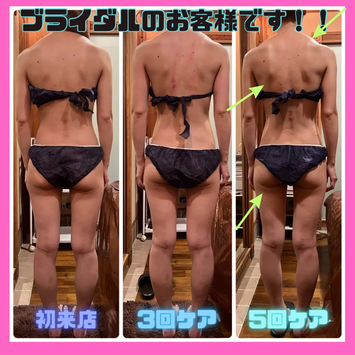 痩身&美肌サロン 堀米✨のその他イメージ