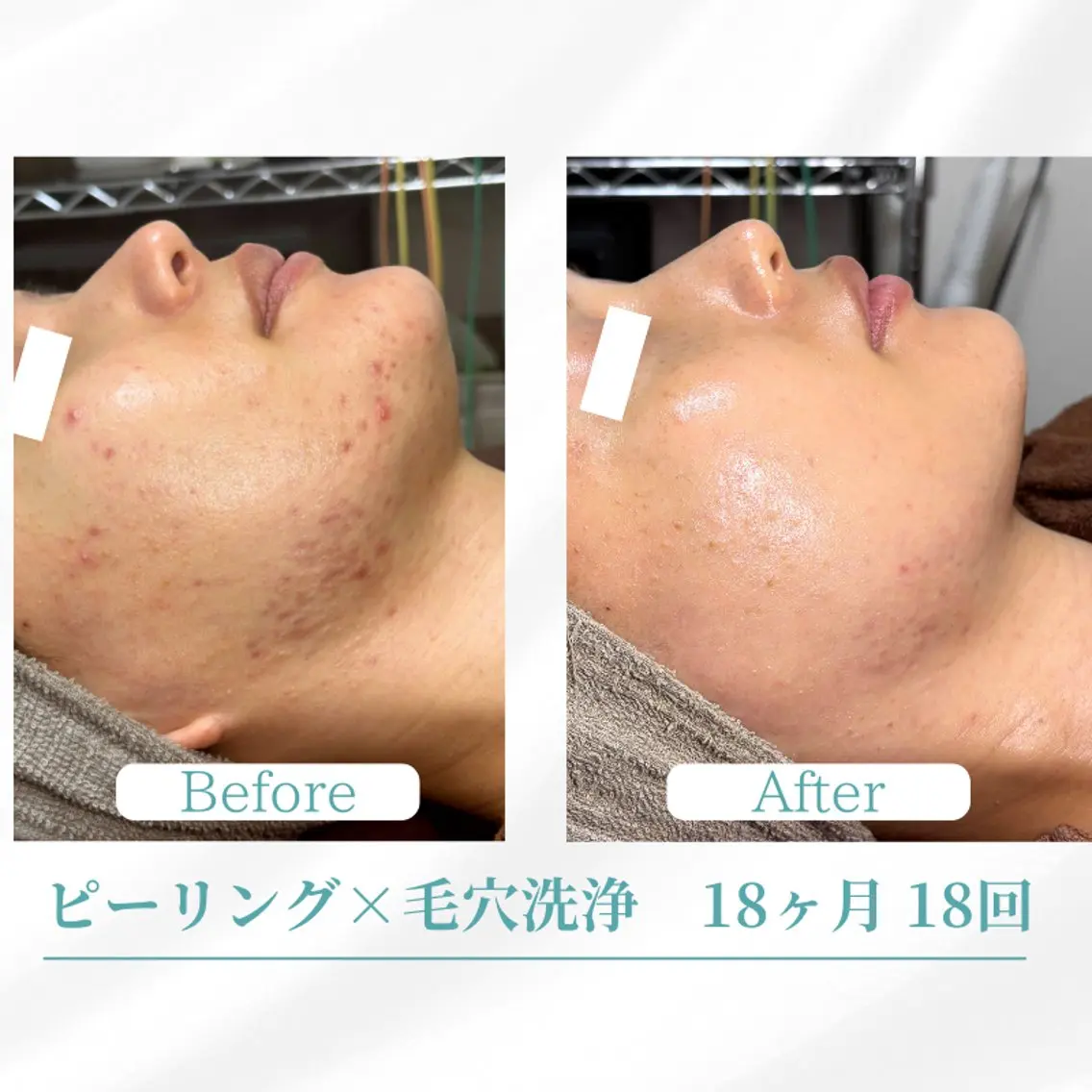 エステ 美容鍼サロン ボディコンディションのエステ・リラクイメージ