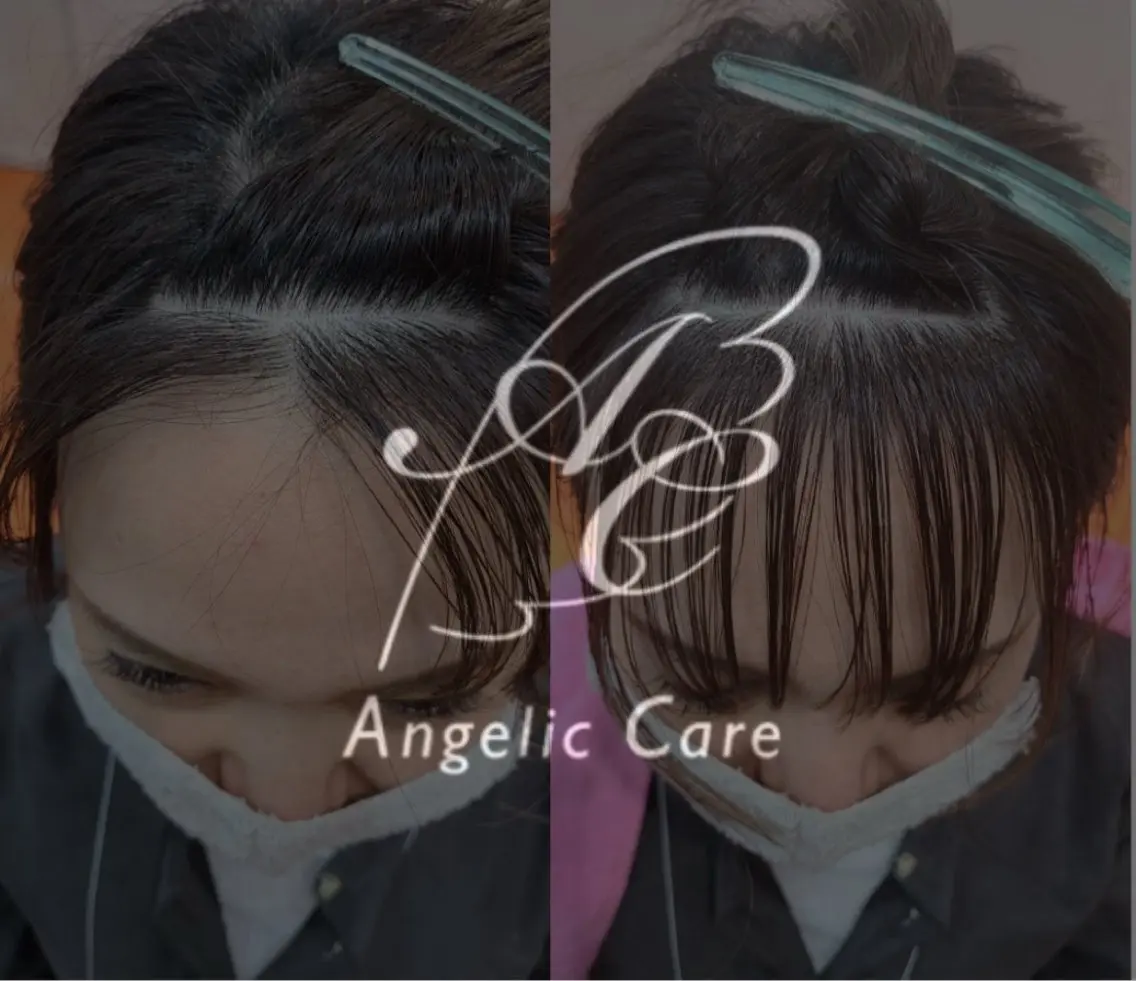 《前髪・分け目》生えグセ改善AC（ポイント）＋シャンプーブローの写真