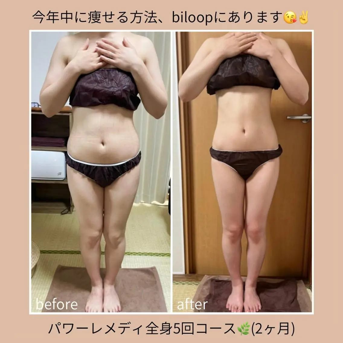 《本気痩せ×疲労改善 》 BILOOPのエステ・リラクイメージ