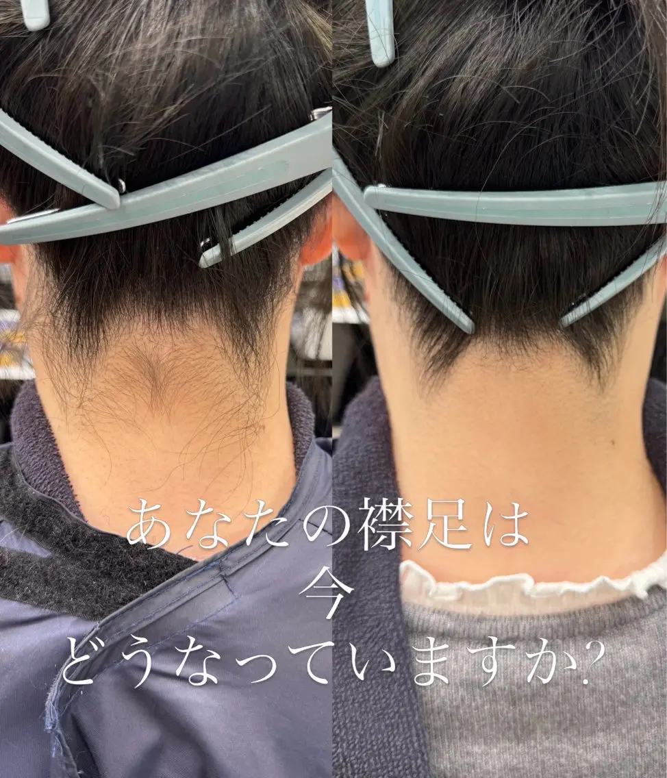 脱毛 田端 奈緒のヘアスタイル