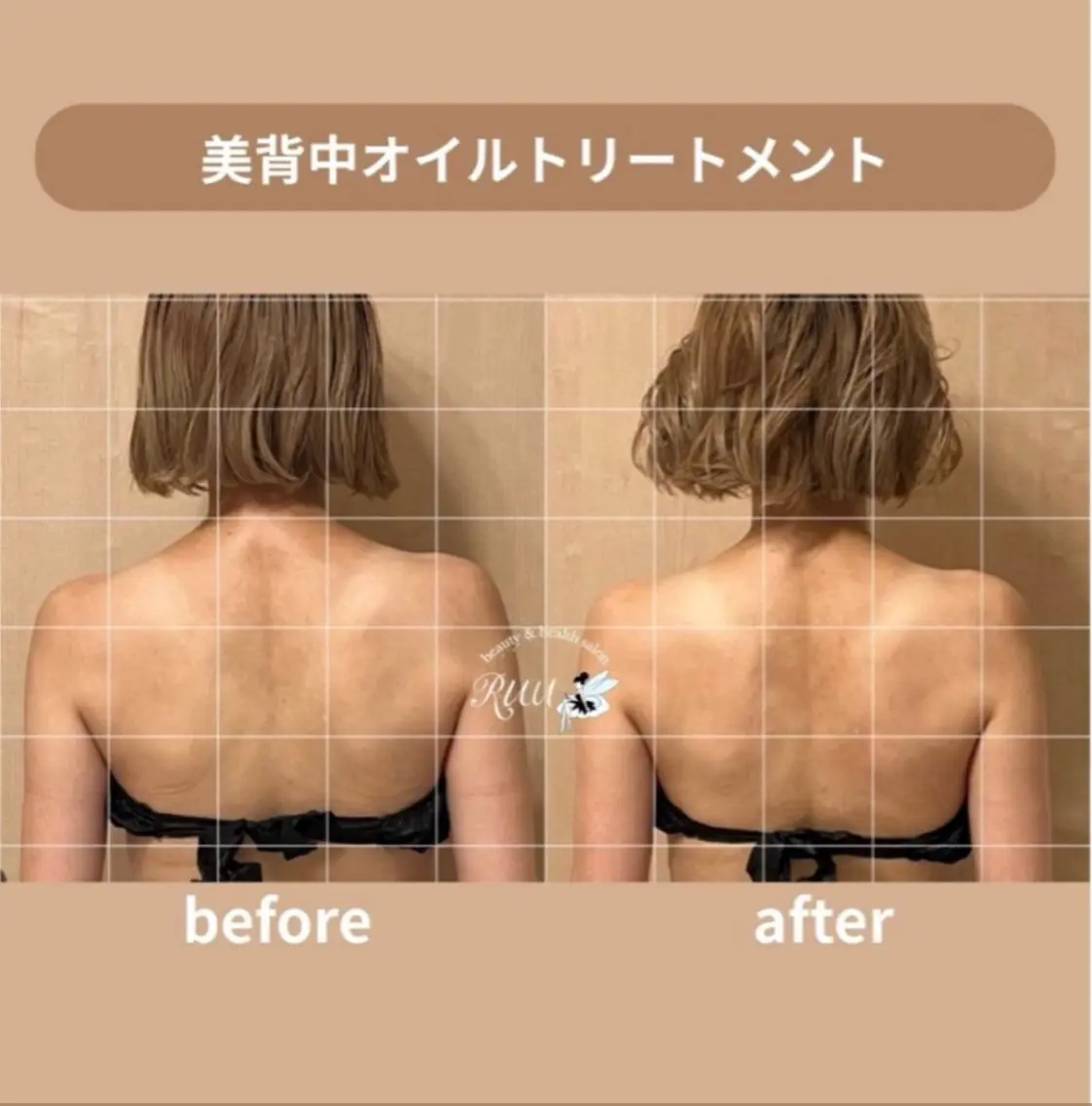 【慢性首肩こり・体のだるさが抜けない方へ】美背中オイルトリートメント モニターの写真