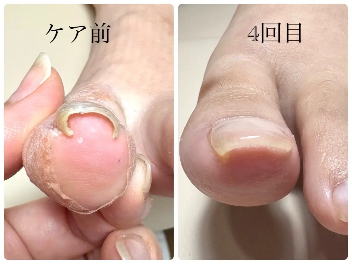 荒井 恵のネイルデザイン