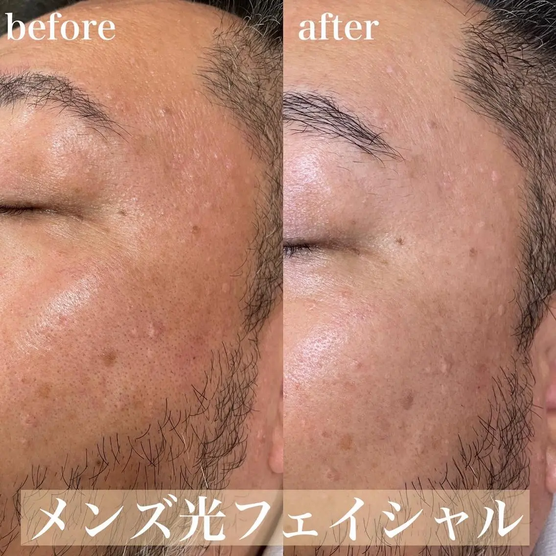メンズ mish eyebrowのエステ・リラクイメージ