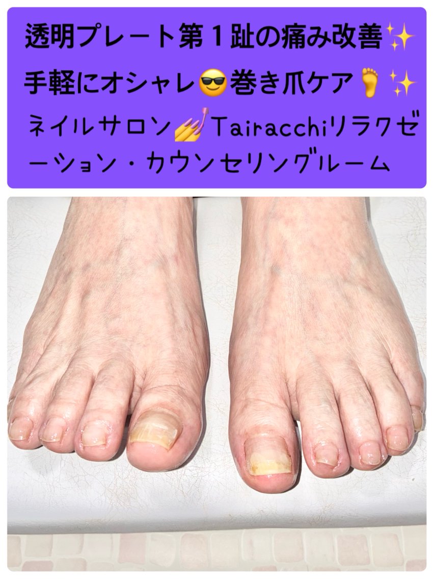 ネイル フットネイル Tairacchi ﾀｲﾗｯﾁのネイルデザイン