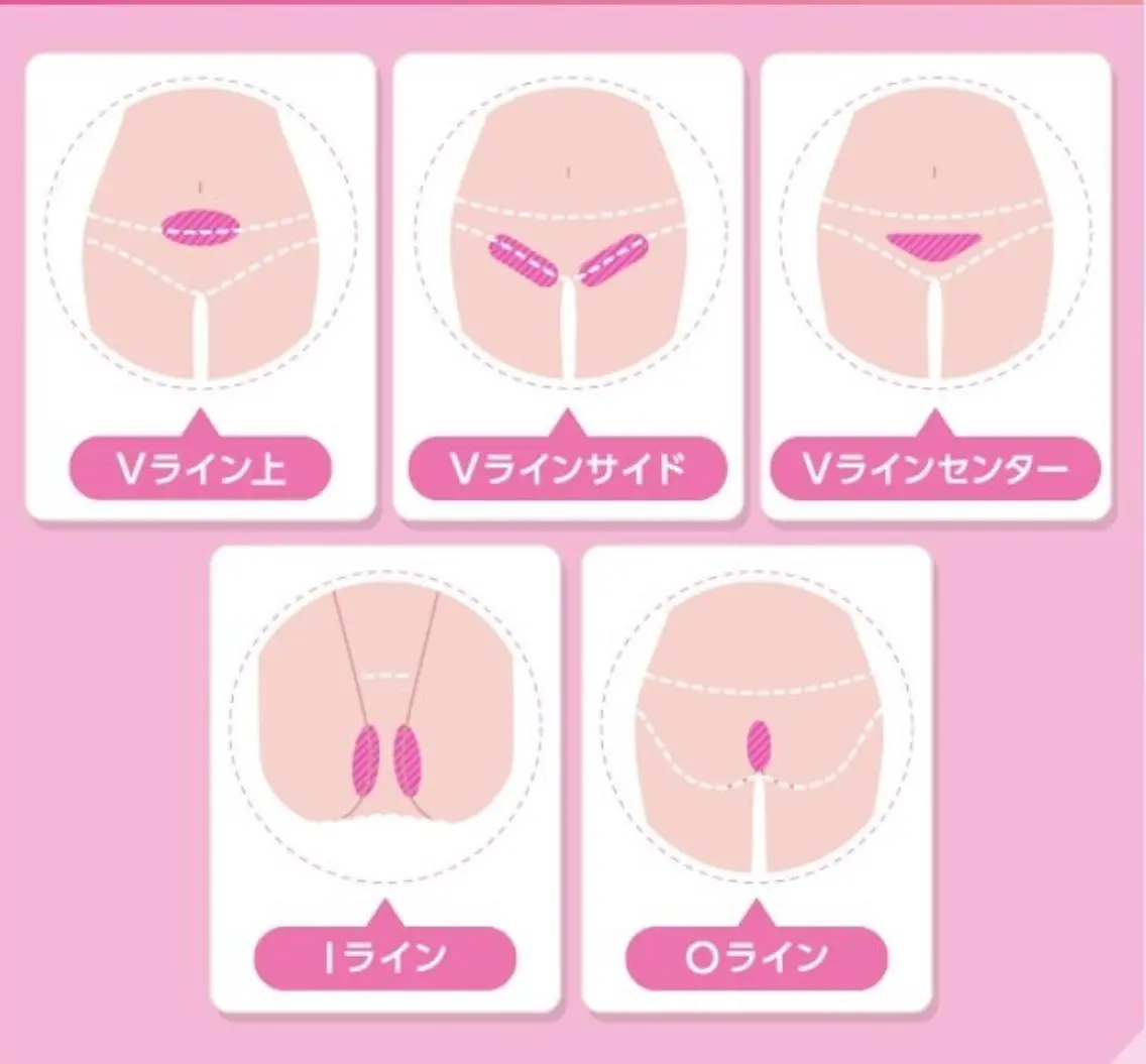 🌙VIO美肌脱毛🌙冷却機能・デザイン自由・ホワイトニング👌本気で毛をなくしたい方必見💍目指せ自己処理いらず肌🌟の写真