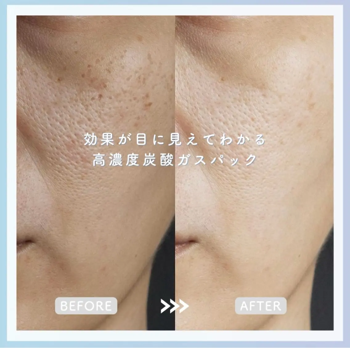 エステ Rifuro毛穴ケア &よもぎ蒸しサロンのエステ・リラクイメージ