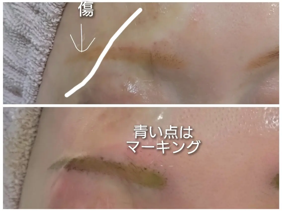 アイブロウ 【トータル美容】 Eternityのその他イメージ
