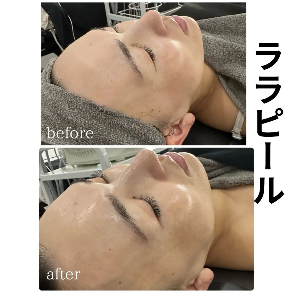ララピール✨エリア初導入！の写真