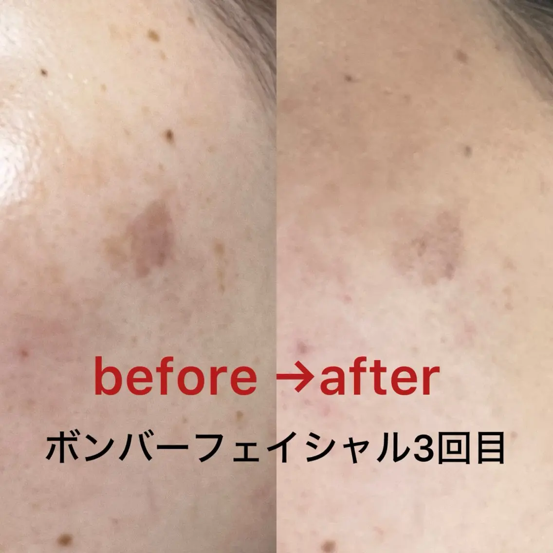 エステ LaBeIIevie ラベルヴィのマツエク・マツパデザイン