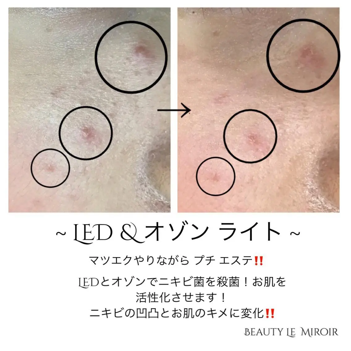ビューティー ミロワールのエステ・リラクイメージ