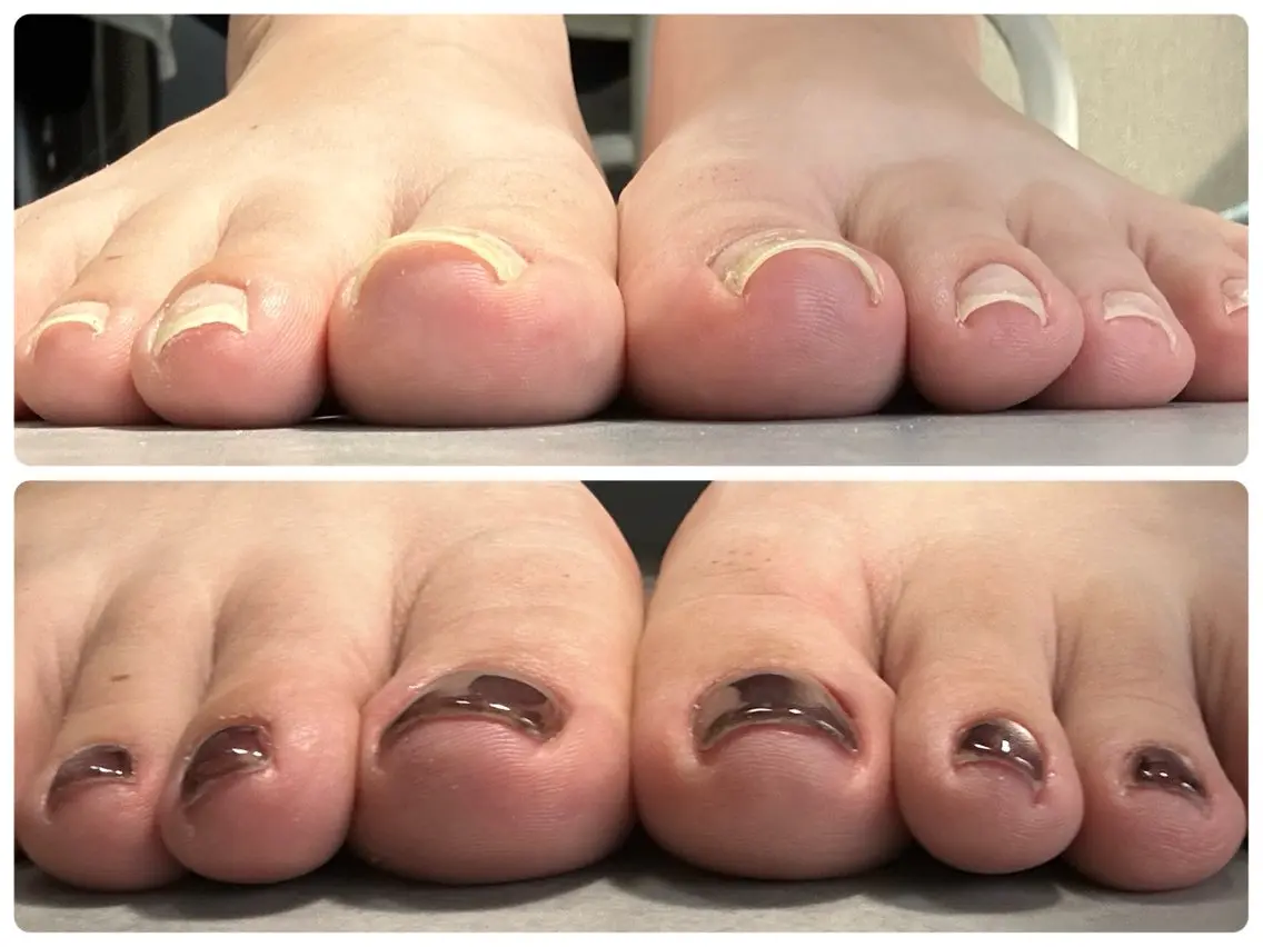 ネイル nail myuu 【ネイルミュー】のネイルデザイン