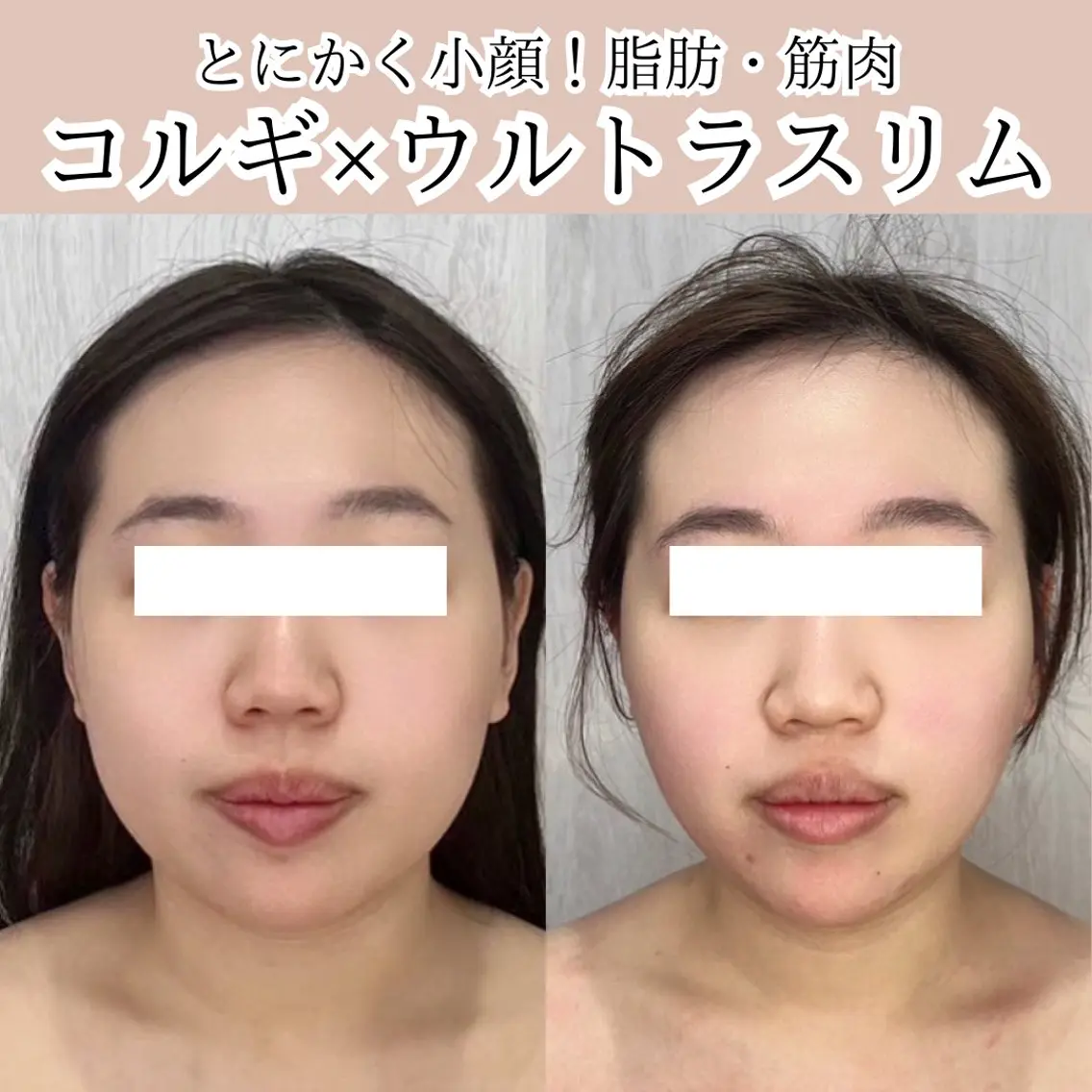第一印象専門サロン ADISEのエステ・リラクイメージ