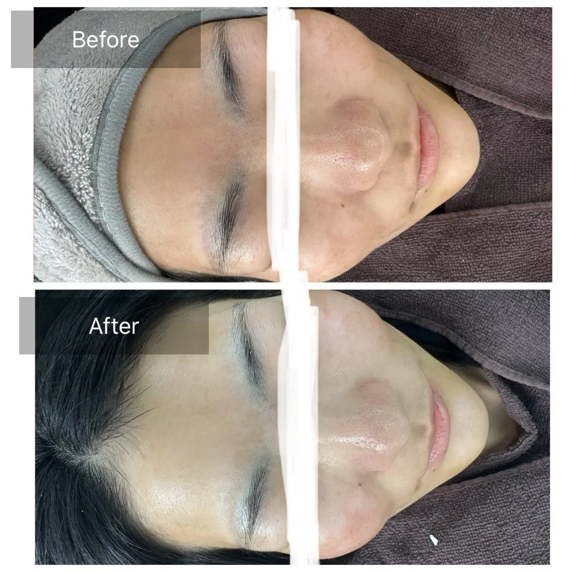 脱毛 トータルしみケア専門 NICA(ニカ)の眉毛・アイブロウイメージ
