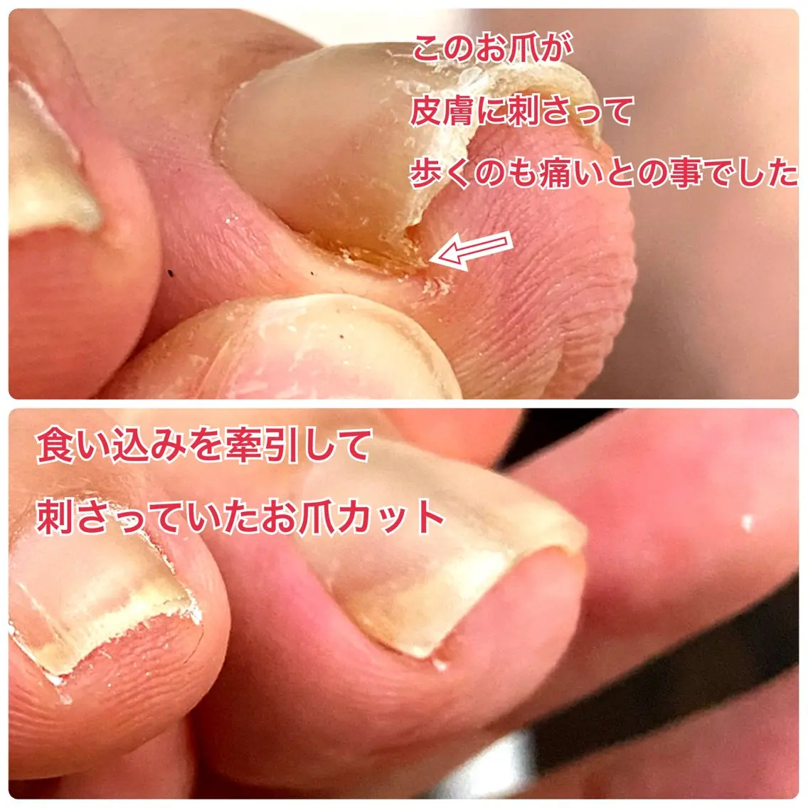 ネイル フットネイル フットネイル Lotus Nailのネイルデザイン