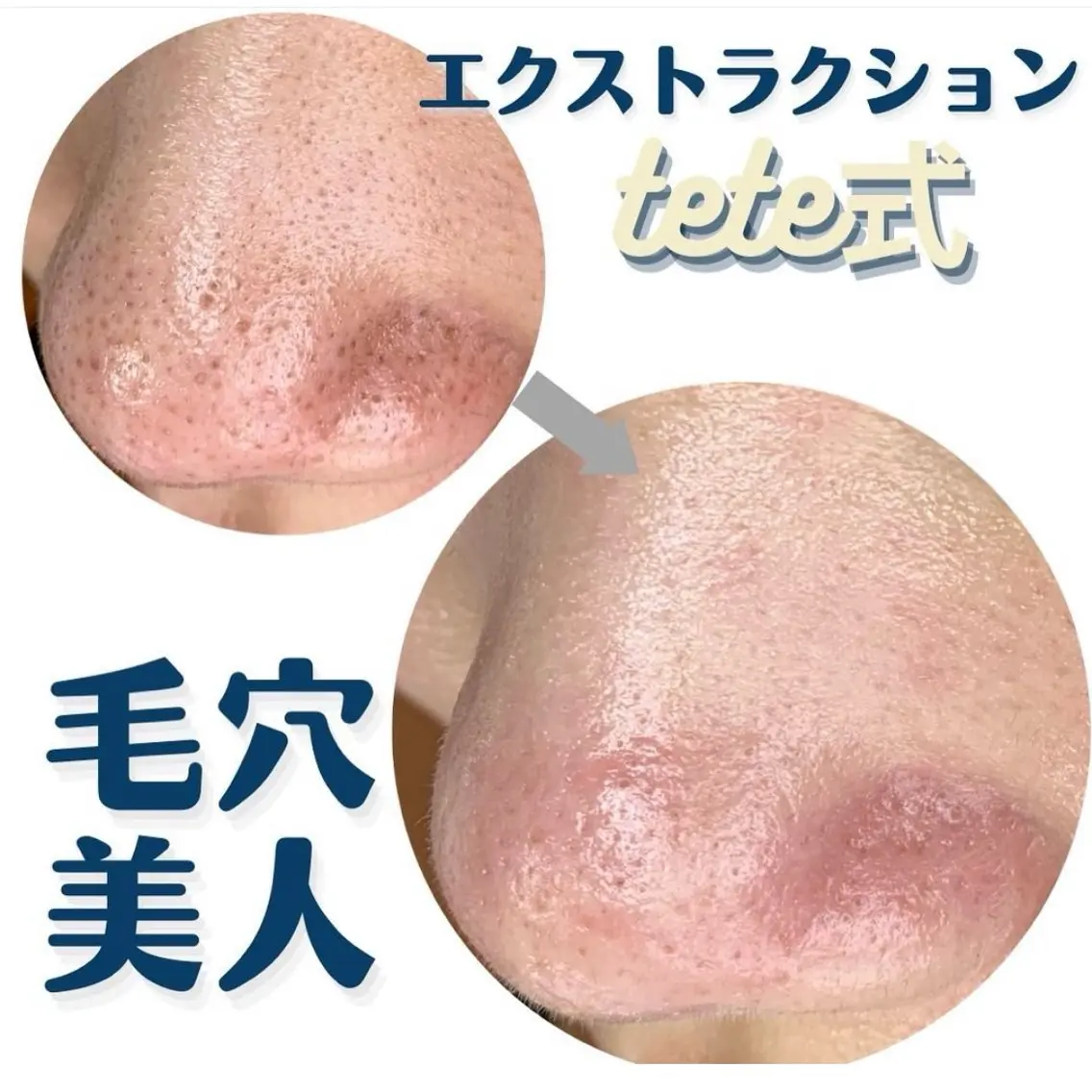 エステ SOLEILnail &beautyのネイルデザイン