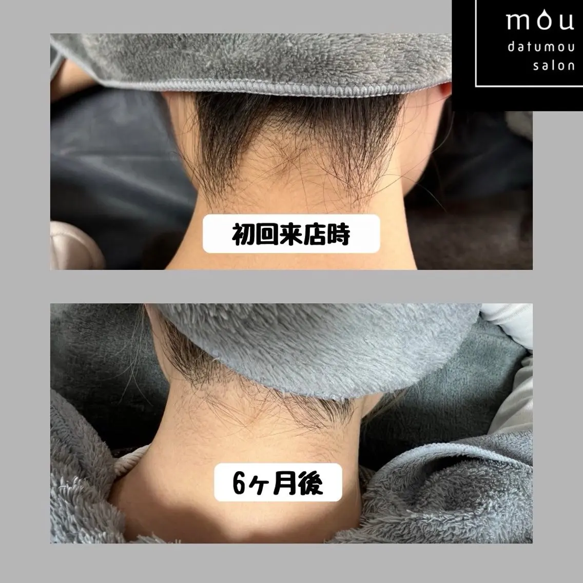 脱毛 moudatumou salonのエステ・リラクイメージ
